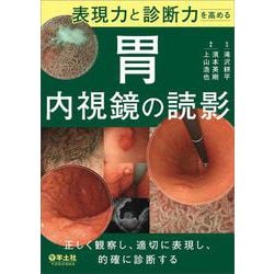 表現力と診断力を高める　胃内視鏡の読影 [単行本]