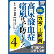 名医がカラー図解！ 高尿酸血症・痛風は予防できる！ (4) 専門医での診断と治療（インプレス） [電子書籍]