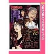 膿んだ傷跡 【単話売】（宙出版） [電子書籍]