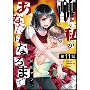 醜い私があなたになるまで（分冊版） 【第11話】（ぶんか社） [電子書籍]