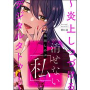 消せない「私」 ～炎上しつづけるデジタルタトゥー～（分冊版） 【第11話】（ぶんか社） [電子書籍]